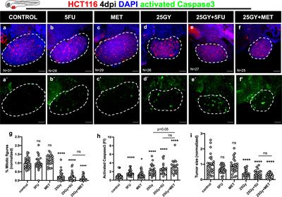 Zebrafish Avatars of rectal cancer patients validate the radiosensitive effect of metformin